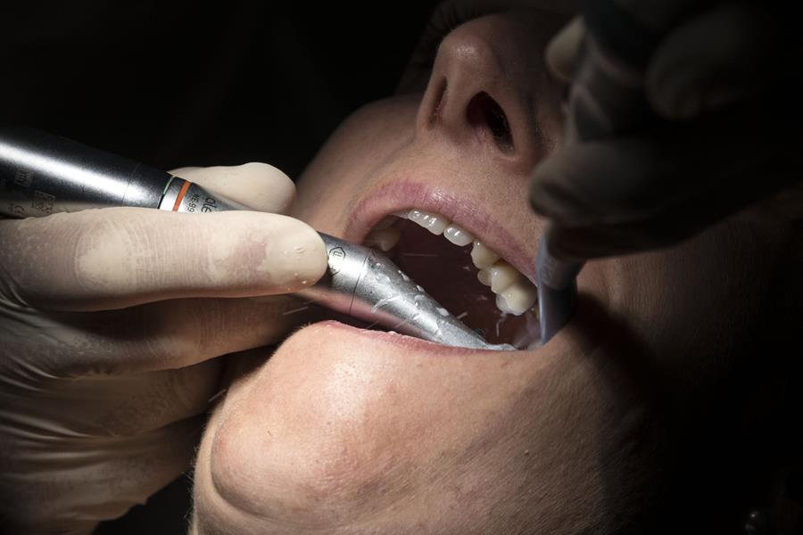 Plus d'un dentiste sur deux n'est pas conventionné