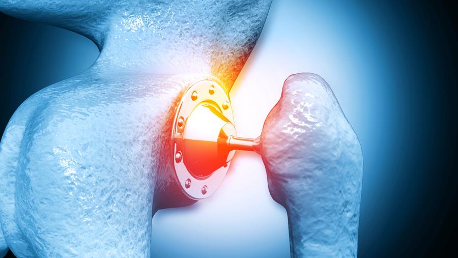 Avancée majeure de l'UCLouvain pour le traitement des infections sur prothèses